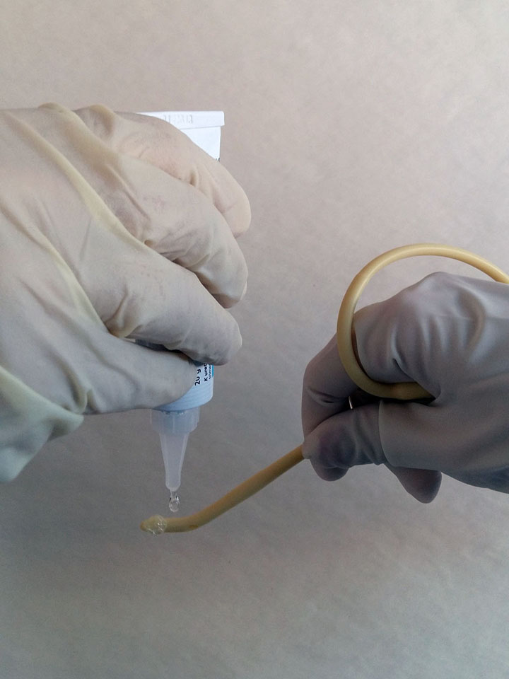 Aplikace Mesocain gelu při zavádění močového katetru u mužů (před nanesením gelu na katetr vymáčkneme cca 1 cm gelu mimo katetr, aplikátor gelu se nesmí dotknout katetru)