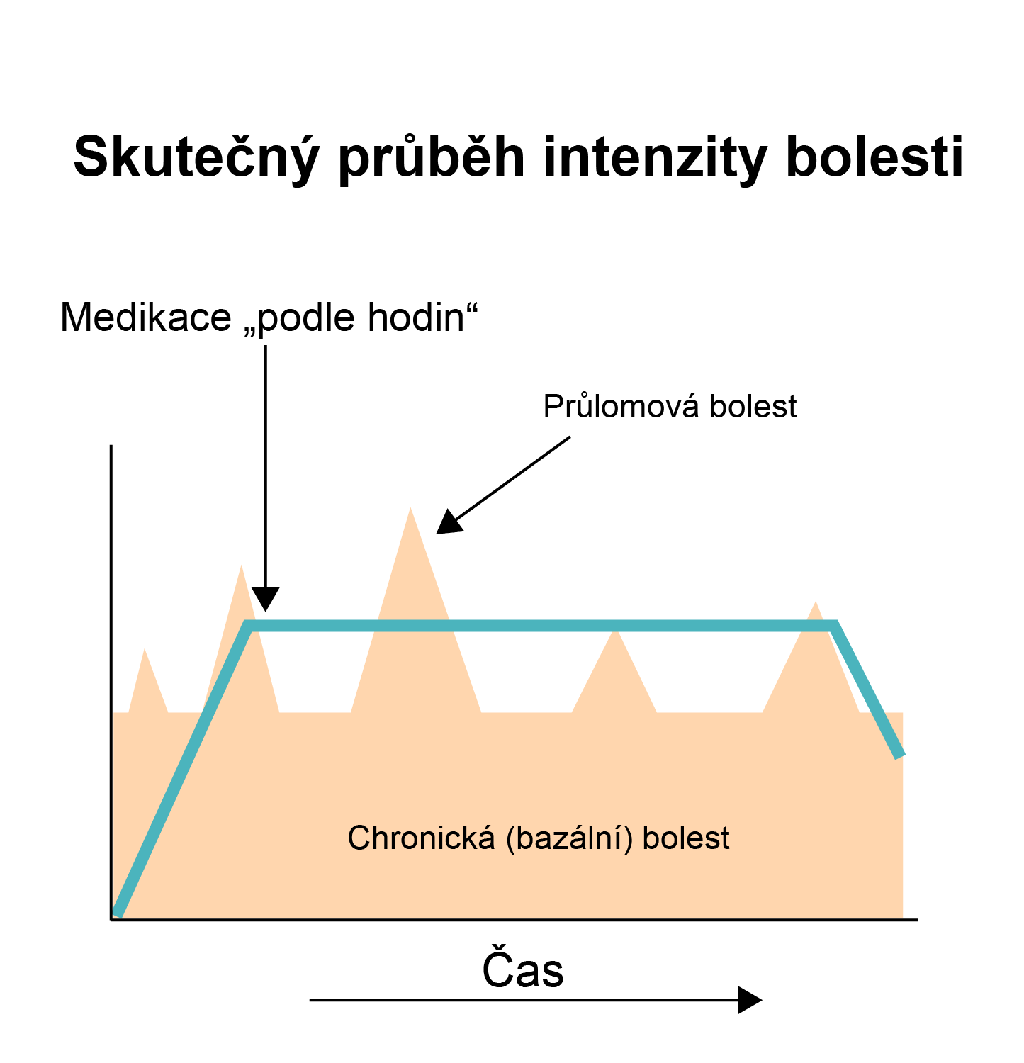 Co je to Průlomová bolest?