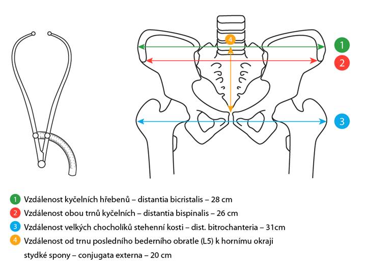 Pelvimetr a schéma pelvimetrie