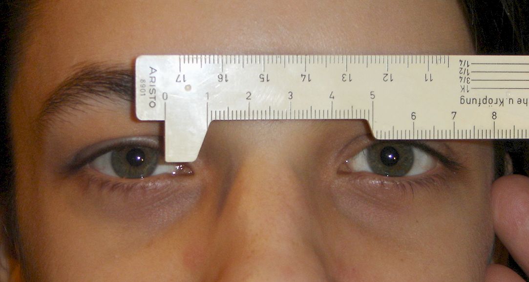 Pupillary distance and its measurement