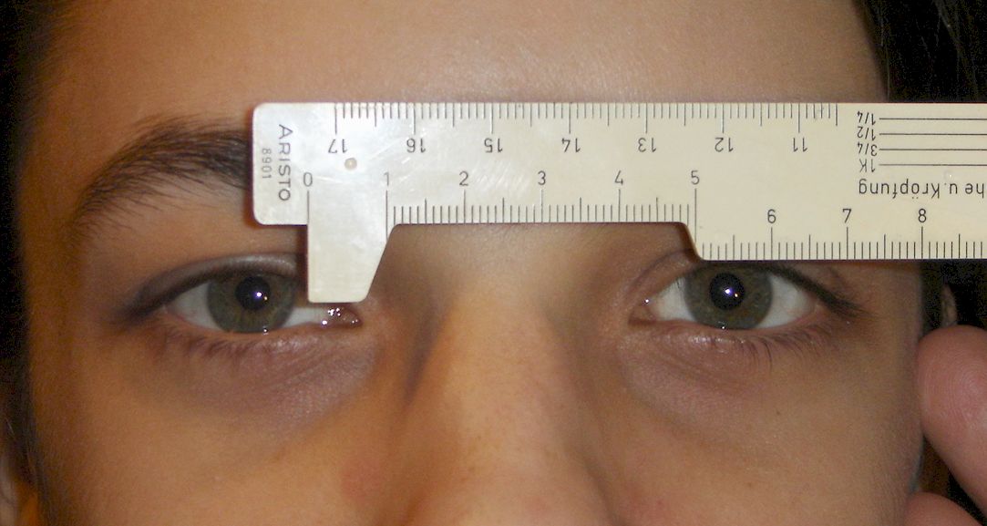 pupillary-distance-measurement-for-far-spectacle-technique-i