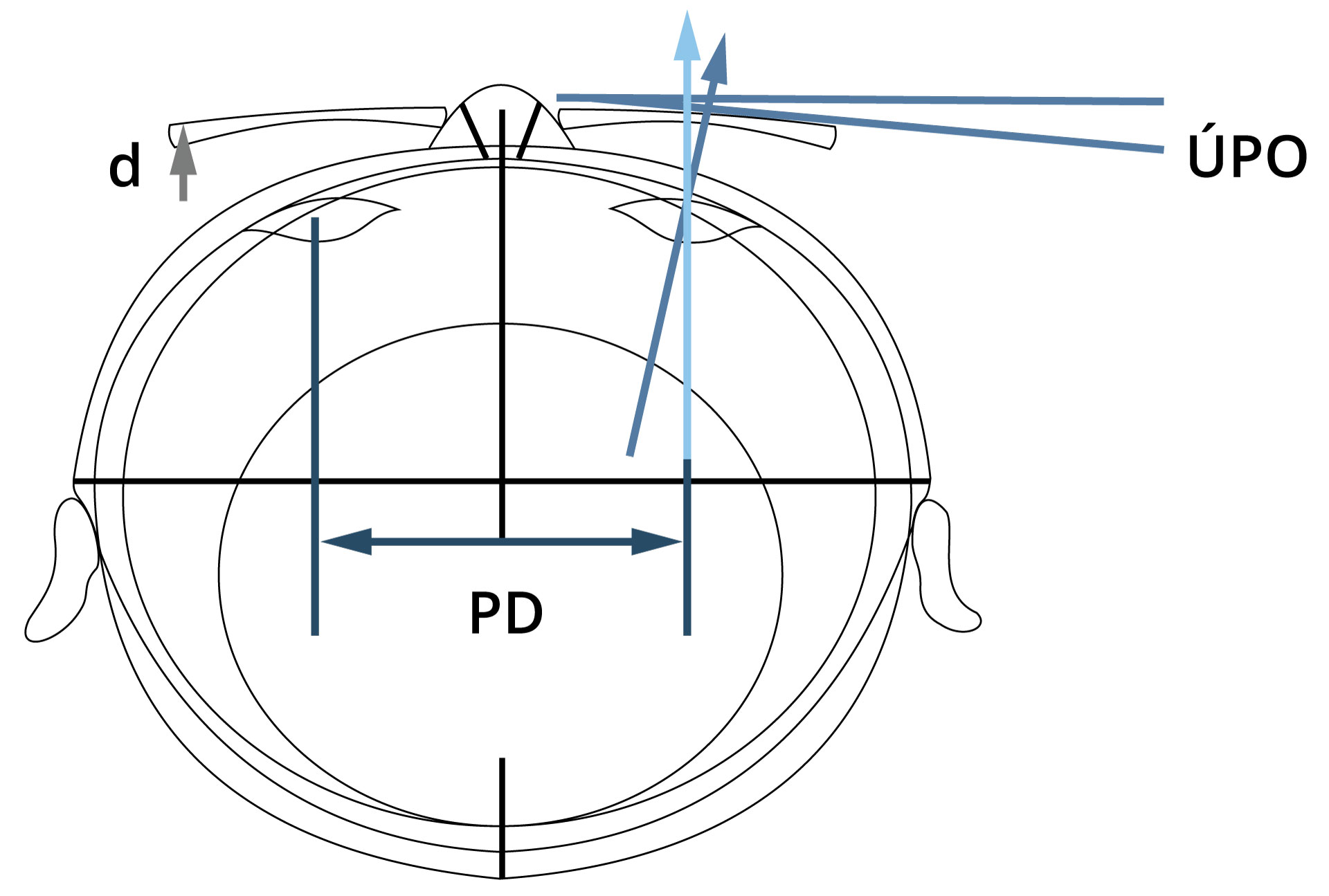 Wrap angle in spectacle frame (green arrow = axis of the spectacle lens, red arrow = fixation axis) (inspired by Eyesite 2013)