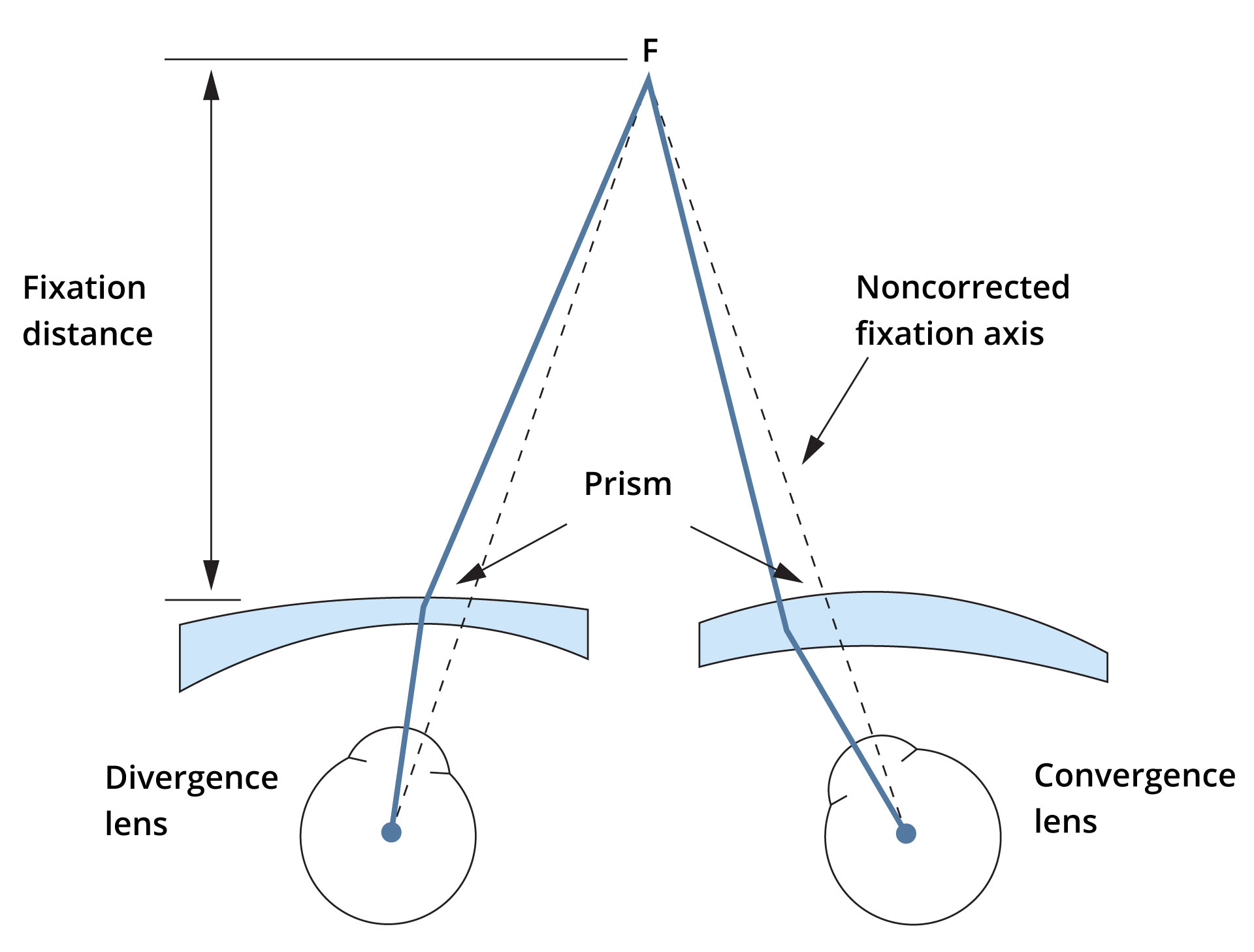 Near convergence demands in convex and concave lens