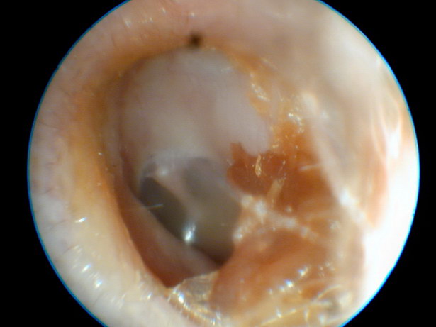 Nástěnný cerumen