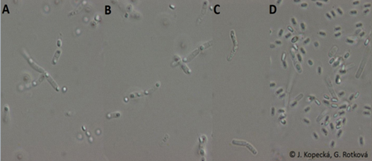 Nomarského kontrast u sporulujících bakterií