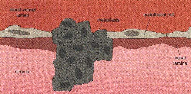 Metastatická nádorová buňka