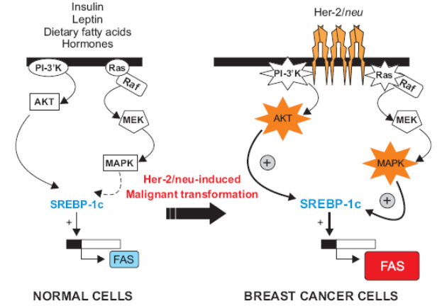 Zvýšení exprese a aktivity FASN během buněčné transformace u nádorů prsu