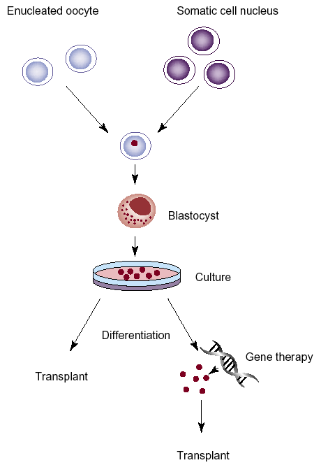 Tvorba emryonálních kmenových buněk přenosem jádra somatické buňky do enukleovaného oocytu