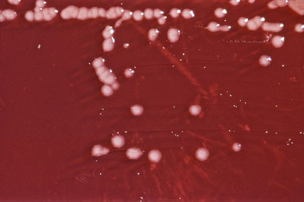 Bakterie rodu Pseudomonas