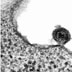 (2 ze 4) Virová částice se spojuje s buněčnou membránou a je připravena vypustit obsah do buňky. Všimněte si viditelného kapsidu (vnitřního pouzdra).