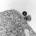 (3 ze 4) Virová částice pučí z buňky. Ačkoli jde o situaci velmi podobnou předchozímu snímku, vnitřní pouzdro viru (kapsid) není tak výrazně kondenzované. Proto se jedná o „nedospělý“ virion, který se tlačí ven, narozdíl od zralého viru, který s buňkou fúzuje, aby ji infikoval.