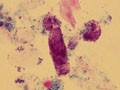 Ukázka z publikace Mikroskopické vyšetření moče